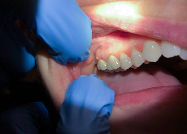 Best Same-Day Emergency Dental Services in Haw River, NC