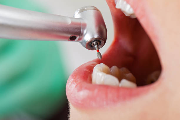 Best Pediatric Emergency Dentist in Haw River, NC